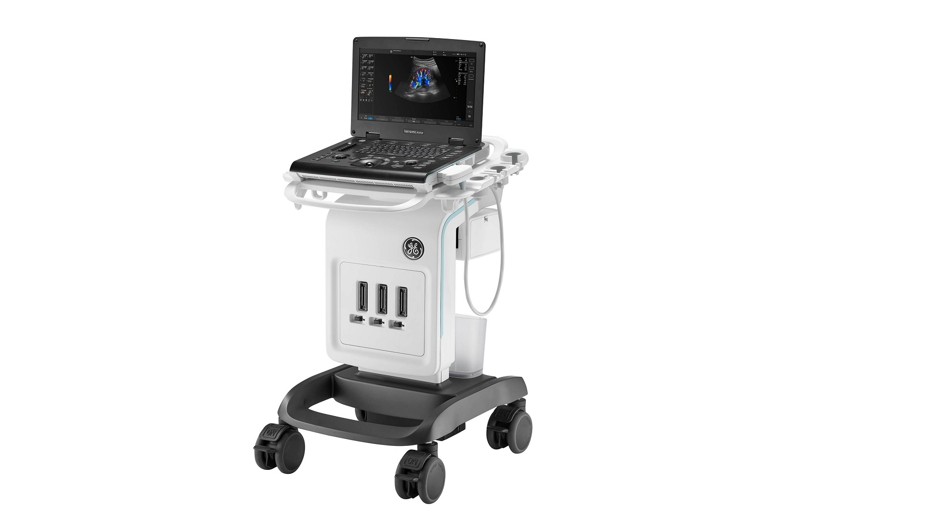 Wipro GE Healthcare starts local manufacturing of its Versana Ultrasound in India