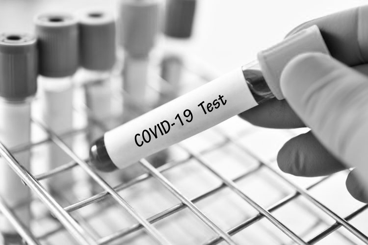 First Made in India COVID-19 tests kit by Pune-based Mylab gets commercial approval